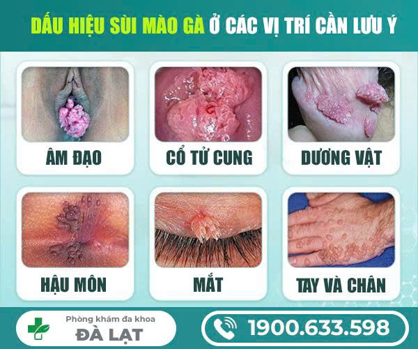 Hình ảnh minh họa